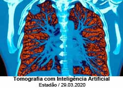 Tomografia com Inteligncia Artificial - Estado / 29.03.2020